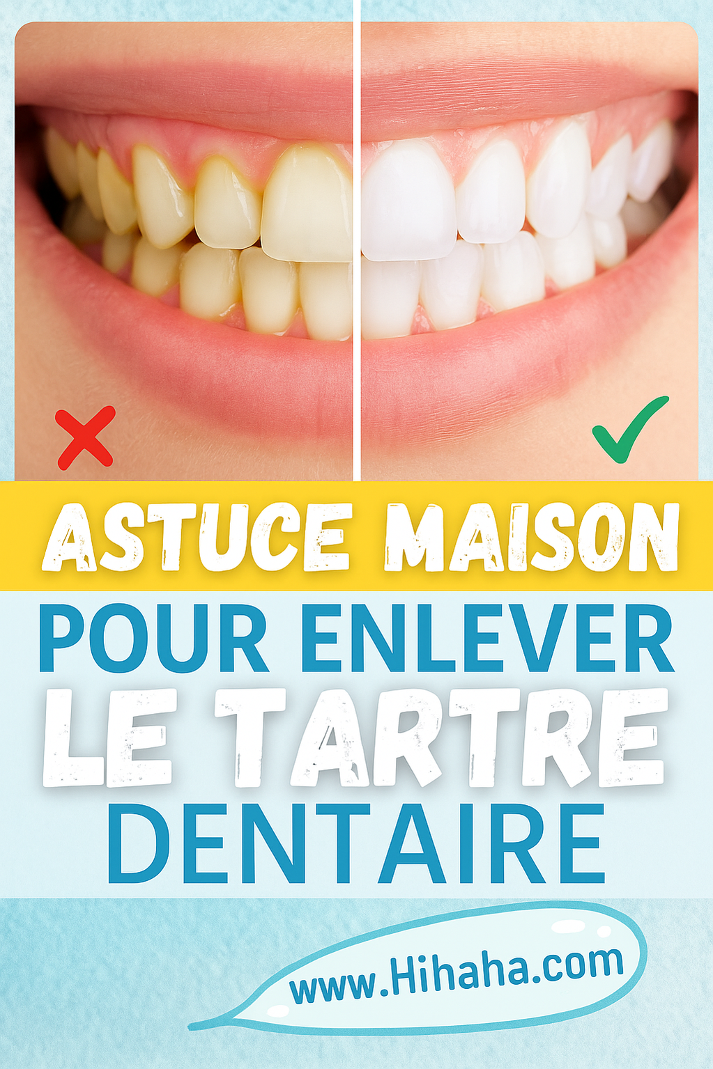 Astuce de Mamie pour enlever le tartre dentaire naturellement